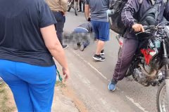 Estudiante atropellado inicia una compleja recuperación