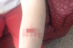 Alumna fue apuñalada por otra estudiante en colegio de Asunción