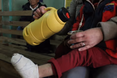 Salud brinda consejos para evitar quemaduras en niños