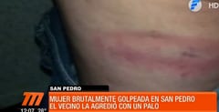 Mujer denuncia a su vecino por golpiza