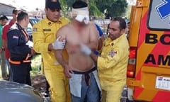 Brasileño se saca un ojo con las manos en Ciudad del Este