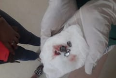 Policía resulta herido durante cateo en Lambaré