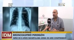 Niño será operado para extraer balín de aire comprimido