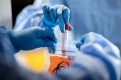 Promedio de casos en Central se estabilizó, afirma médico