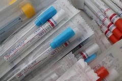 Tres fallecidos y 68 sin nexo, confirma Salud