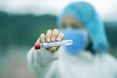 Salud reporta gran incremento de contagios