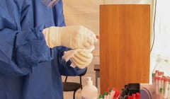 Salud confirma 10 fallecidos y pico de positivos