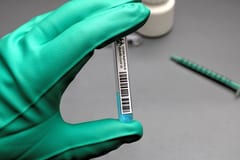 10 vacunas anticoronavirus son las más adelantadas, según OMS