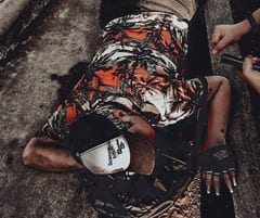 Ciclista sufre múltiples fracturas tras ser atropellada
