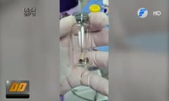 Operan a niño para extraerle el eje de un cortaúñas