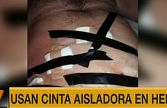 Uso de cinta aisladora en paciente es montaje, según Salud