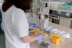 Paraguay activa alerta epidemiológica por viruela del mono 