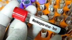 Confirman seis nuevos casos de viruela del mono en la última semana