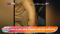 Niño de dos años sufre mordedura de serpiente en San Pedro