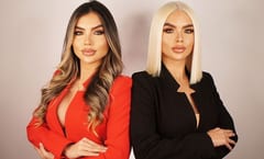 Biopsia revela uso no autorizado de PMMA en paciente de “doctoras Barbies”