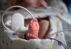 Dengue causa muerte de bebé prematura