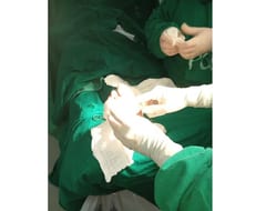 Tratamiento con larvas evita amputaciones en pacientes diabéticos