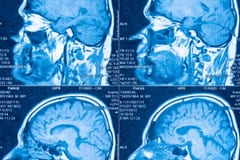 El cerebro humano está formado por dos órganos distintos, revela estudio