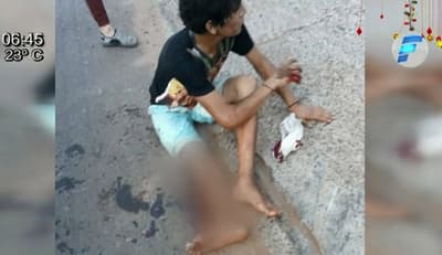 Supuesto motochorro pierde una pierna luego de atraco