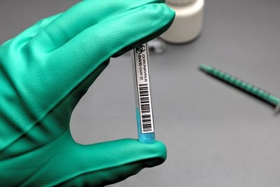 10 vacunas anticoronavirus son las más adelantadas, según OMS