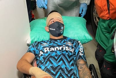 Villasanti sufre conmoción cerebral tras ataque a bus 