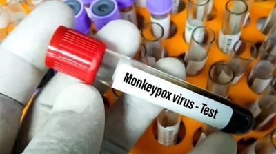 Confirman seis nuevos casos de viruela del mono en la última semana