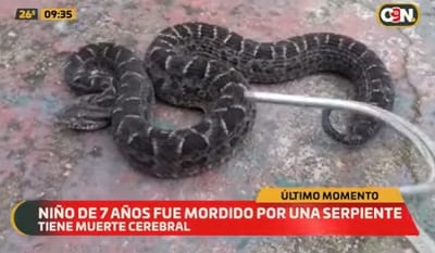 Niño está con muerte cerebral tras sufrir mordida de serpiente