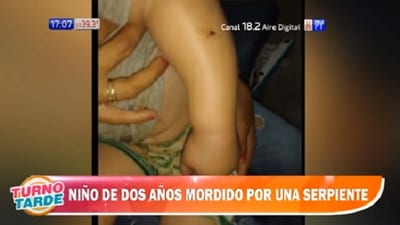 Niño de dos años sufre mordedura de serpiente en San Pedro