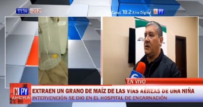 Extraen grano de maíz de vías respiratorias de niña en Encarnación