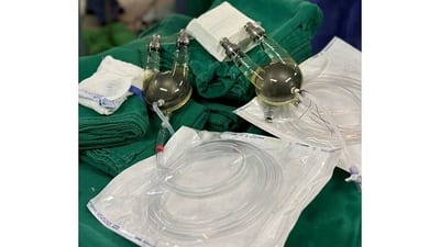 Adolescente recibe corazón artificial en espera de trasplante