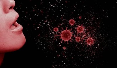 Aumentan casos de tuberculosis en Paraguay