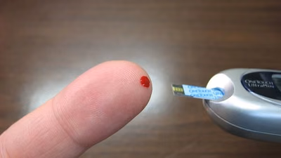 Relación entre cáncer y diabetes: estudio revela datos clave