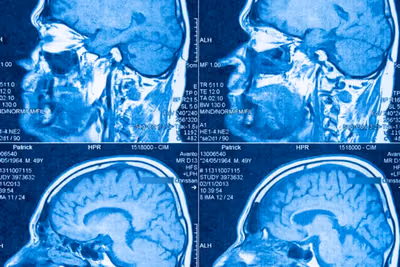 El cerebro humano está formado por dos órganos distintos, revela estudio