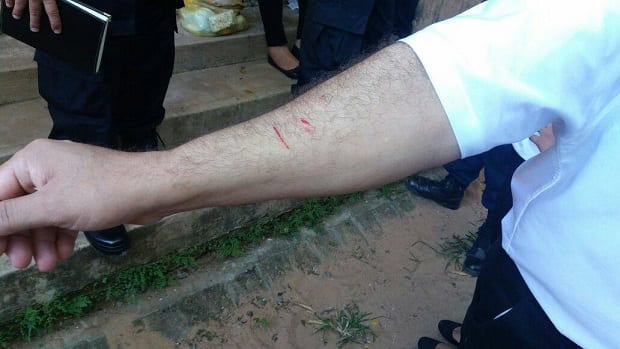 Mujer agredió a Marito