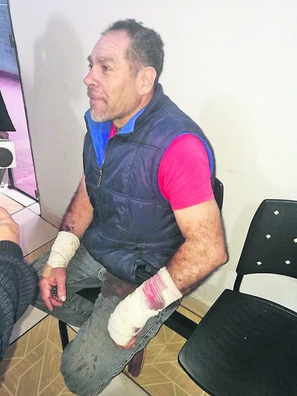 Pitbull salva a mujer de agresión