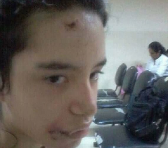 Madre pide ayuda para tratamiento de su hija tras accidente