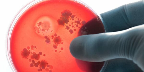 La meningitis: Una enfermedad grave y contagiosa explicada en 10 datos