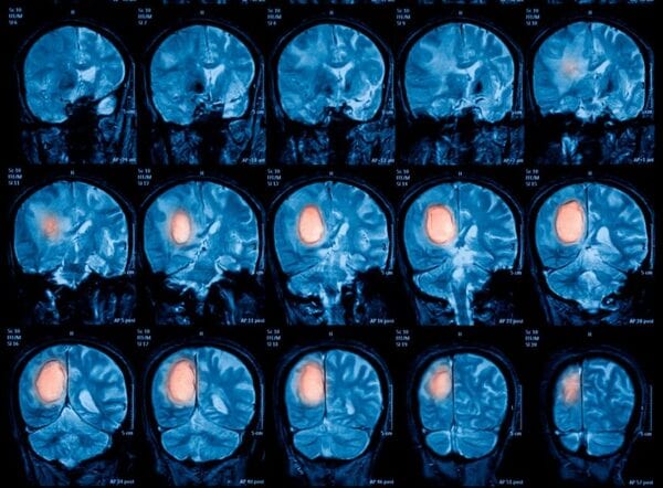 Los 10 pasos de una intervención quirúrgica nunca antes vista en Paraguay