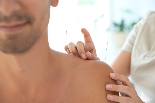 Acupuntura en la salud pública: 10 datos para saber de qué se trata