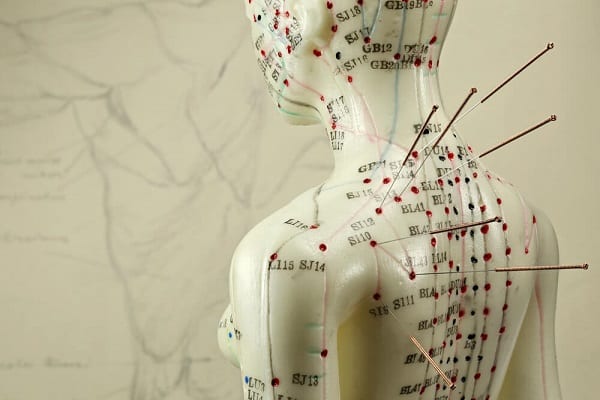 Acupuntura en la salud pública: 10 datos para saber de qué se trata