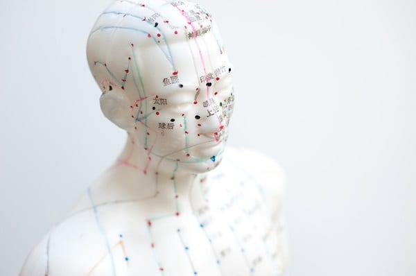 Acupuntura en la salud pública: 10 datos para saber de qué se trata