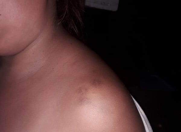 Mujer denuncia negligencia en juzgado en proceso por violencia familiar
