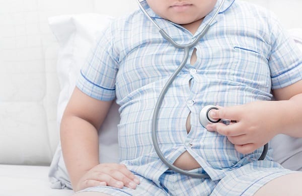 10 datos sobre el aumento de niños obesos en Paraguay