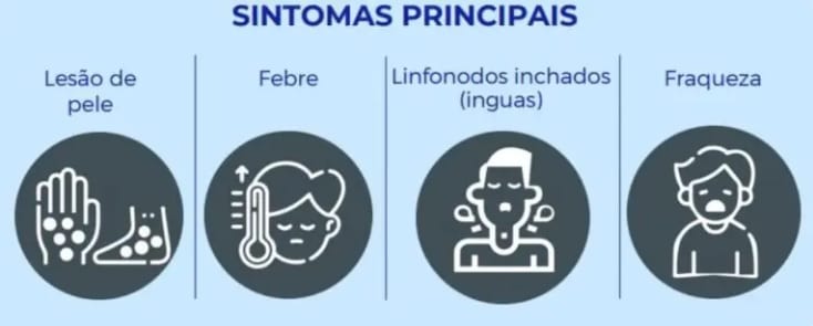 Confirman primer caso de viruela del mono en Foz de Iguazú