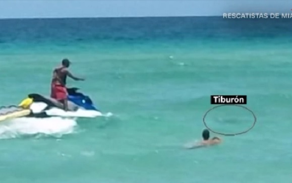 Hombre es atacado por tiburón en playa de Miami