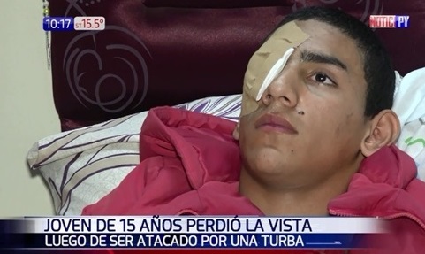 Joven pierde un ojo luego de ser atacado por una turba