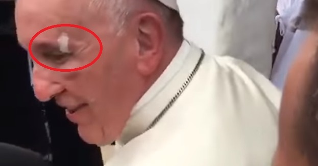 Papa Francisco se golpea en su visita a Cartagena y bromea sobre lo sucedido