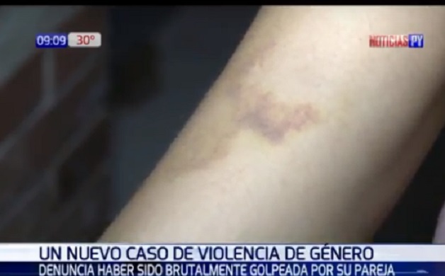 Mujer denuncia amenazas luego de ser golpeada