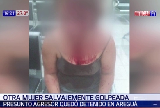 Víctima de violencia tuvo que huir a Argentina