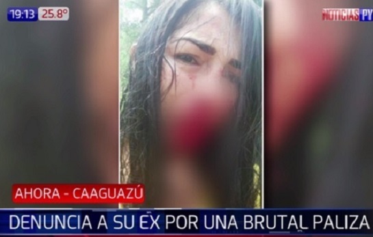 Mujer denunció a su expareja por golpearla y policía no lo detuvo
